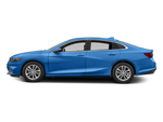 2017 Chevrolet Malibu LT 1LT